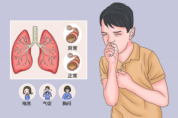 过敏性哮喘病
